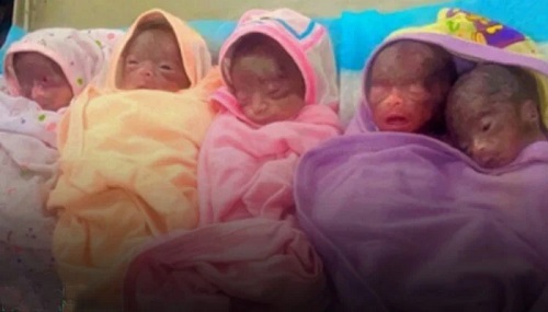 women gives birth to six children in karachi