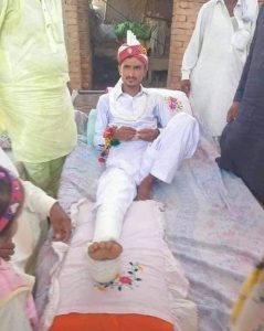 groom with broken leg on wedding